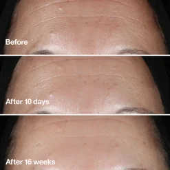 Smart Clinical Repair™ Wrinkle Correcting Serum korygujące serum przeciwzmarszczkowe 50ml